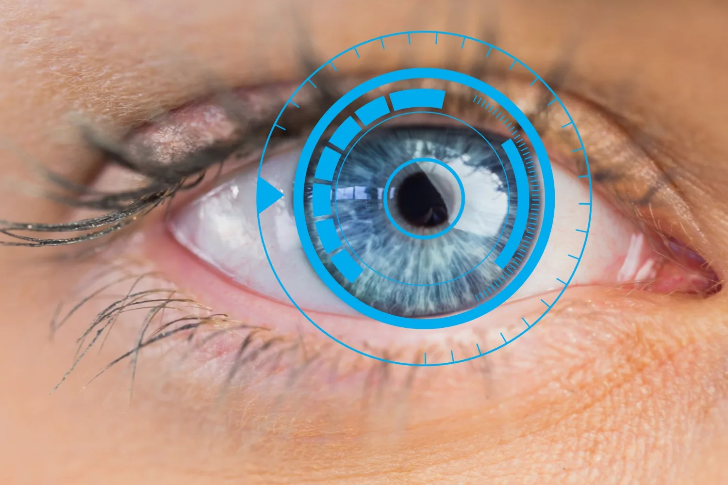 Cirugía de desprendimiento de retina
