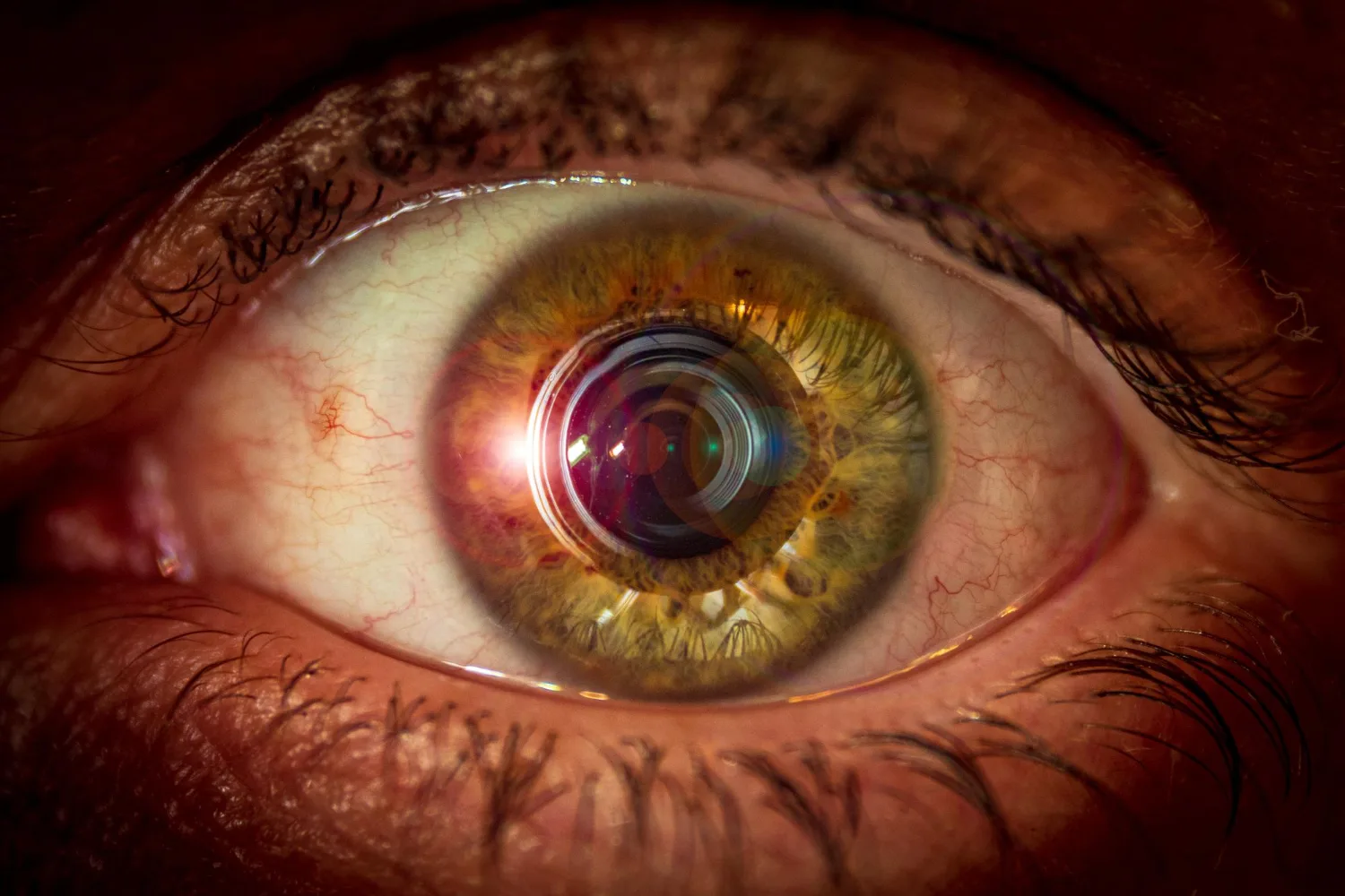 Cirugía macular en CDMX: Recupera tu visión con atención especializada