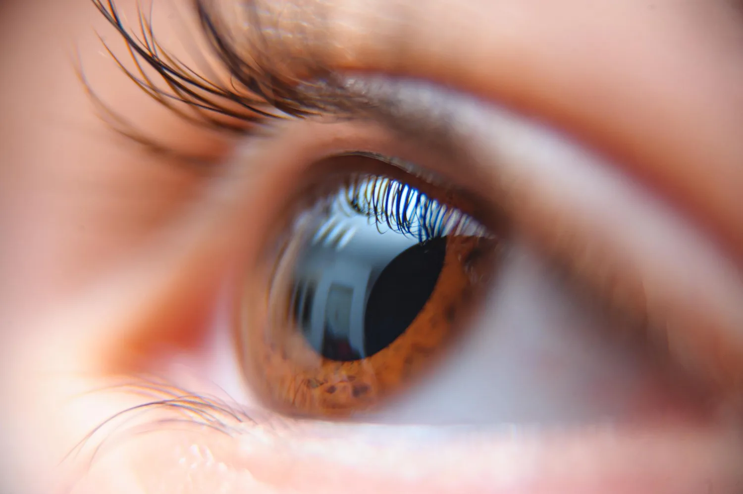 Fotografías de segmento anterior en CDMX: Diagnóstico Ocular de Alta Precisión